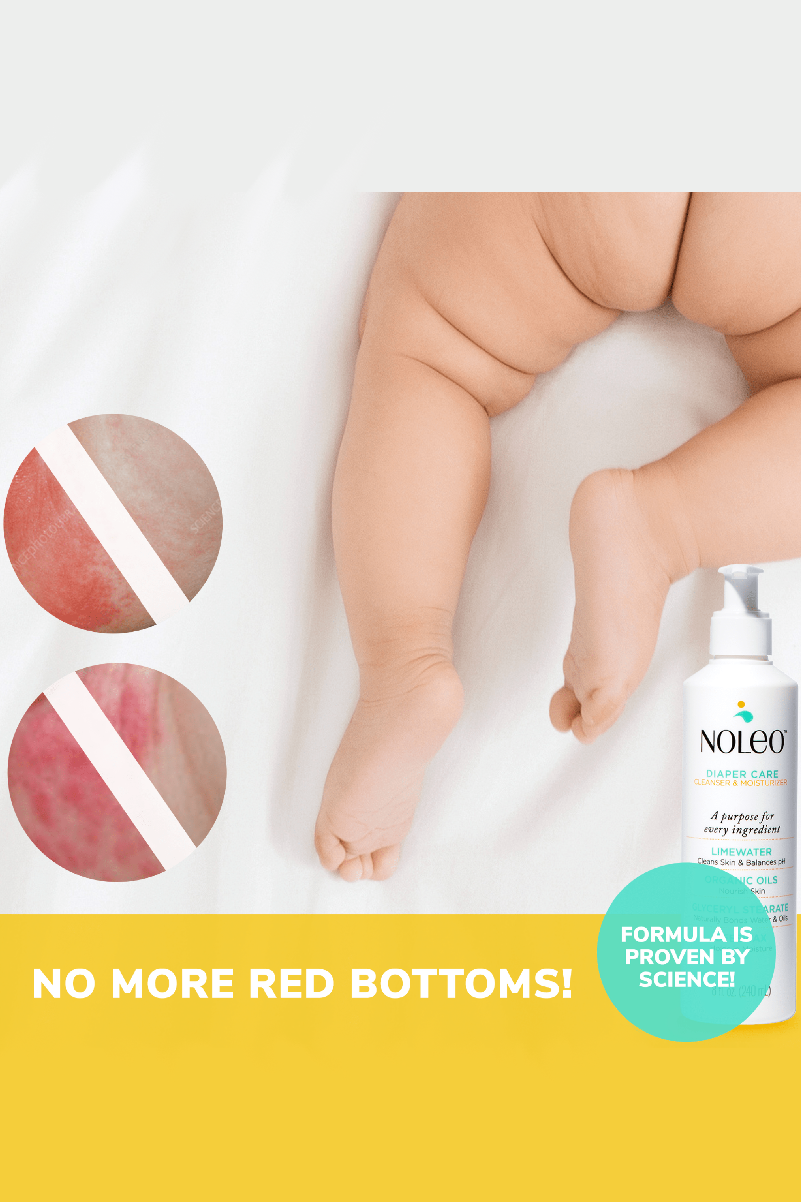 NOLEO Diaper Rash Cream & Cotton Pads, Bundle